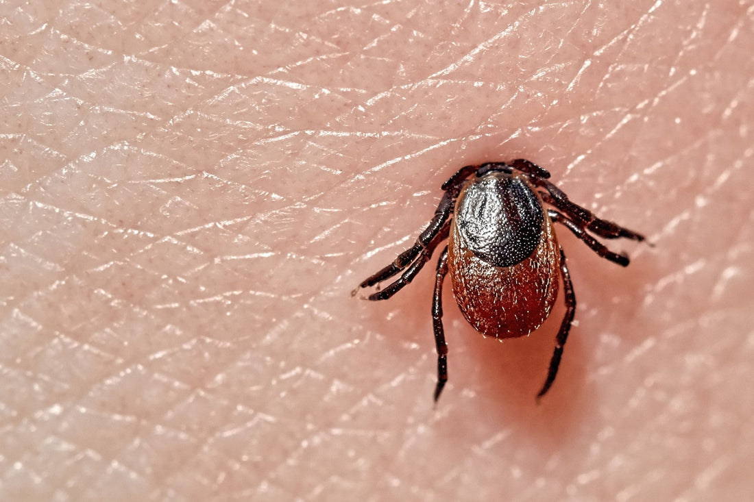 Tick embeded in skin-Mammalian meat allergy blog